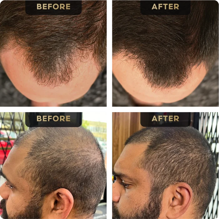 Hair Concealer, image 2. The Beard Struggle