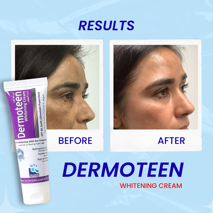 Dermoteen Cream ( Make skin glowing, fair, radiant & smooth )