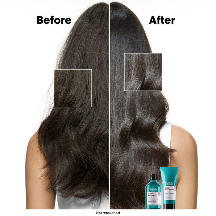 L'Oreal Professionnel Scalp Advanced Anti-Discomfort Shampoo
